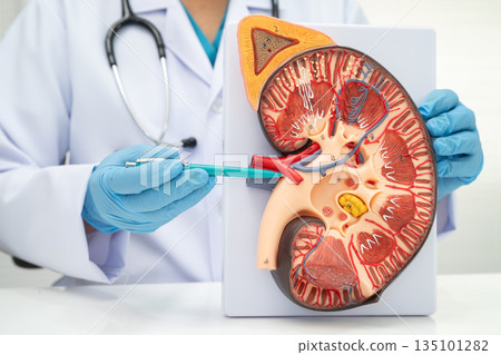 Kidney disease, Chronic kidney disease ckd, Doctor hold human model to treat and study in hospital. 135101282