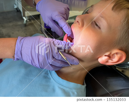 Teenage boy at dental checkup close-up 135132033
