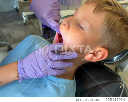 Teenage boy at dental checkup close-up Teenage boy at dental checkup close-up 135132034