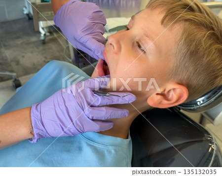 Teenage boy at dental checkup close-up 135132035