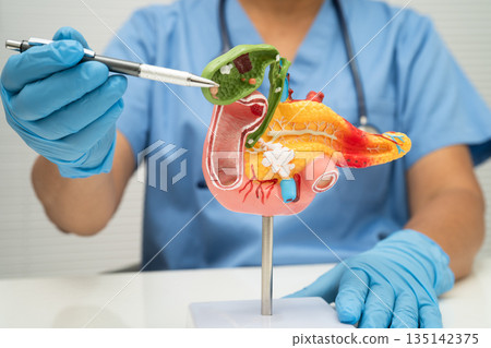 Pancreatitis, pancreatic cancer, Asian doctor with pancreas, gallbladder and bile duct human anatomy model at hospital. 135142375
