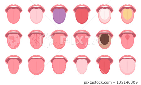 舌部狀況插圖資料集 135146309