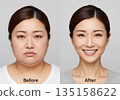 一位日本女性節食後臉部發生了顯著變化，以下是節食前後照片的對比。 135158622