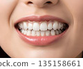 一位女士戴著矯正器，露出潔白美麗的牙齒，笑容燦爛。 135158661