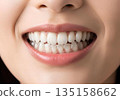 一位女士戴著矯正器，露出潔白美麗的牙齒，笑容燦爛。 135158662