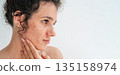 portrait of a sad teenage girl with pimples and acne on problematic facial skin. Face of adult woman with bad red inflamed skin and acne in close up on white isolated background 135158974