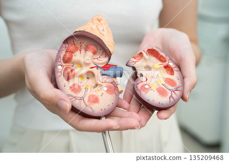 Cirrhosis, Liver cancer, fatty liver, Asian woman with liver human anatomy model. 135209468
