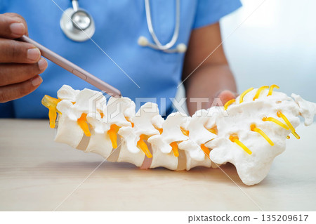Asian doctor holding spinal nerve and bone model, Lumbar spine displaced herniated disc fragment for treatment medical in the orthopedic department. Asian doctor holding spinal nerve and bone model, Lumbar spine displaced herniated disc fragment for treatment medical in the orthopedic department. 135209617