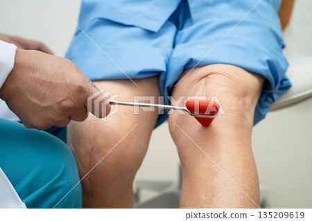 Asian doctor knock on knee reflex nerve for check and treatment senior patient in hospital. Asian doctor knock on knee reflex nerve for check and treatment senior patient in hospital. 135209619