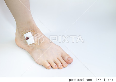 受傷女子的腿 受傷女子的腿 135212573
