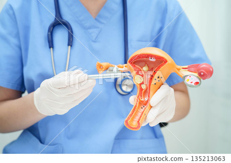 Uterus, doctor holding human anatomy model for study diagnosis and treatment in hospital. Uterus, doctor holding human anatomy model for study diagnosis and treatment in hospital. 135213063