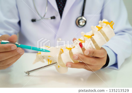 Asian doctor holding spinal nerve and bone model, Lumbar spine displaced herniated disc fragment for treatment medical in the orthopedic department. 135213529