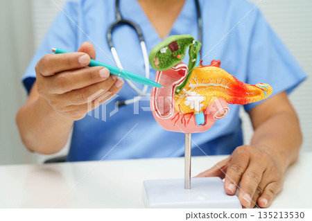 Liver with gallbladder, pancreas spleen and duodenum, Asian doctor holding human anatomy model for study diagnosis and treatment in hospital. 135213530