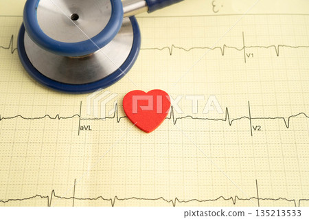 Stethoscope on electrocardiogram ECG, heart wave, heart attack, cardiogram report. Stethoscope on electrocardiogram ECG, heart wave, heart attack, cardiogram report. 135213533
