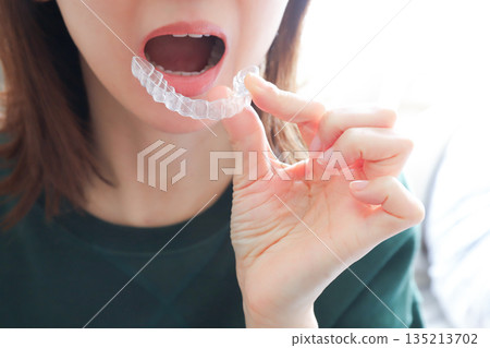 Woman wearing a mouthpiece, orthodontic treatment 135213702