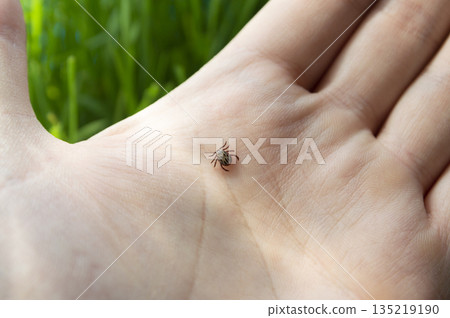 Dangerous biting Tick on a human hand is a carrier of infections and viruses. Dangerous biting Tick on a human hand is a carrier of infections and viruses. 135219190