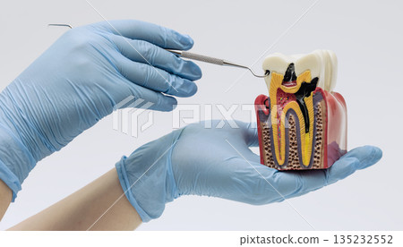 Dental Tooth Anatomy Model With Probe Dental Tooth Anatomy Model With Probe 135232552