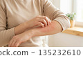 Woman scratching red itchy skin on arm: Allergy and Dermatology concept. 135232610