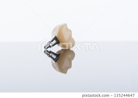 Single dental crown of molar with individual titanium abutment for fixation on implant. 135244647