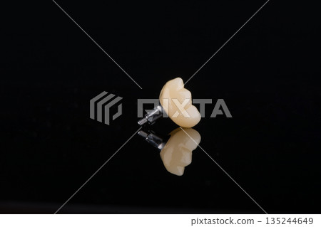 Single dental crown of molar with individual titanium abutment for fixation on implant. Single dental crown of molar with individual titanium abutment for fixation on implant. 135244649