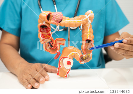 Colorectal cancer, doctor holding intestine colon human anatomy model. 135244685
