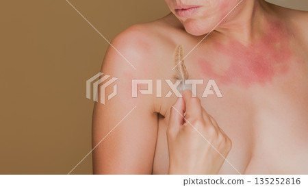 Woman experiencing skin allergy or irritation from feather 135252816