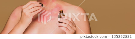 Woman applying serum to irritated skin, treating redness 135252821