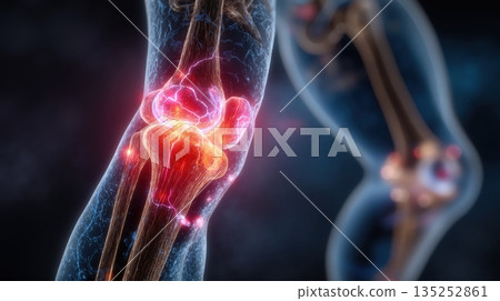 Digital visualization of a human knee joint with red and blue colors highlighting bones and ligaments Digital visualization of a human knee joint with red and blue colors highlighting bones and ligaments 135252861
