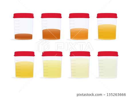 Urine samples with different coloured stock illustrations Urine samples with different coloured stock illustrations 135263666