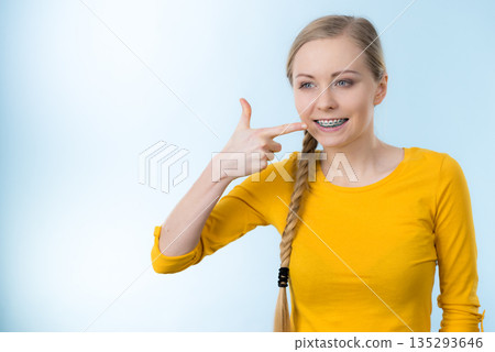 Woman showing her teeth with braces 135293646