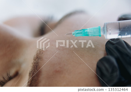 close up of professional hands making a rejuvenation injection into woman frown line close up of professional hands making a rejuvenation injection into woman frown line 135312464
