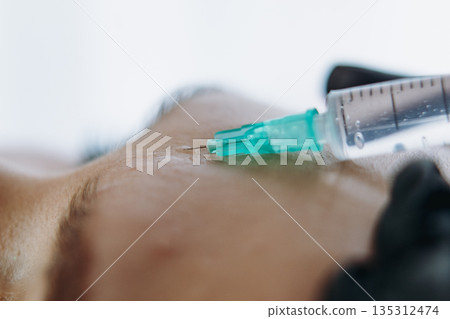 close up of professional hands making a rejuvenation injection into woman frown line 135312474