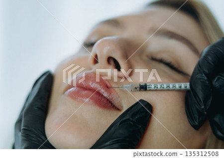 Precision Lip Enhancement: Professional Injectable Treatment in Progress Precision Lip Enhancement: Professional Injectable Treatment in Progress 135312508