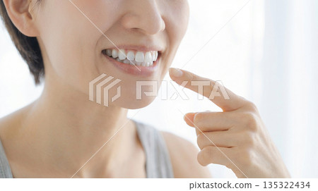 A woman pointing to her white teeth and beautiful alignment 135322434