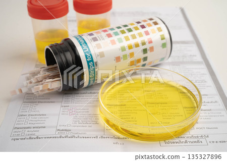 Urinalysis, urine cup with reagent strip pH paper test and comparison chart in laboratory. Urinalysis, urine cup with reagent strip pH paper test and comparison chart in laboratory. 135327896