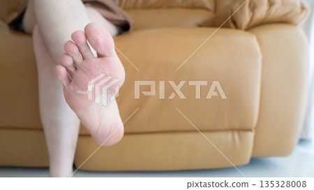 Close up of peeling and cracked foot. Causes of peeling foot included fungal infection (athlete's foot), dermatitis (eczema), sunburn, dry skin, dehydration or sweaty feet. Health care concept. Close up of peeling and cracked foot. Causes of peeling foot included fungal infection (athlete's foot), dermatitis (eczema), sunburn, dry skin, dehydration or sweaty feet. Health care concept. 135328008