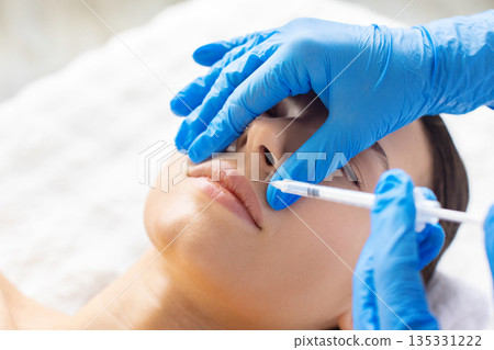 Young woman receiving professional cosmetic injection near lips, gloves and syringe visible Young woman receiving professional cosmetic injection near lips, gloves and syringe visible 135331222