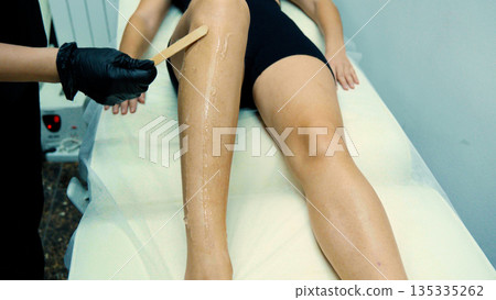 Cosmetologist in uniform working with laser hair removal machine. Cosmetologist in uniform working with laser hair removal machine. 135335262