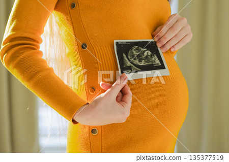Prenatal ultrasound screening. Pregnant woman hands holding sonogram picture of unborn baby inside big belly. Happy expectant mom with fetus usi scan image. Young mother enjoying pregnancy. Maternity Prenatal ultrasound screening. Pregnant woman hands holding sonogram picture of unborn baby inside big belly. Happy expectant mom with fetus usi scan image. Young mother enjoying pregnancy. Maternity 135377519