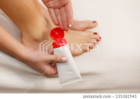Woman putting ointment on bad ankle applying cream 135382543
