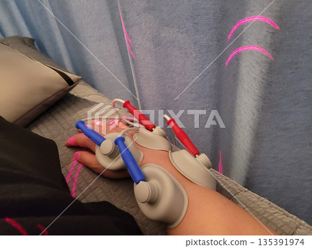 Physical Therapy Treatment Using Electrical Muscle Stimulation Electrodes on a Patient's Hand for Pain Relief Physical Therapy Treatment Using Electrical Muscle Stimulation Electrodes on a Patient's Hand for Pain Relief 135391974
