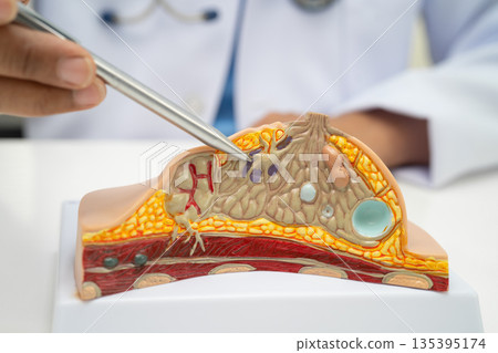 Doctor holding female breast human anatomy model. 135395174