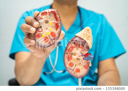Chronic kidney disease, doctor with model for treatment urinary system, urology, Estimated glomerular filtration rate eGFR. Chronic kidney disease, doctor with model for treatment urinary system, urology, Estimated glomerular filtration rate eGFR. 135398080