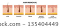 Hair removal methods. Hair, shaving, cream, waxing epilation, laser electrolysis 135404449