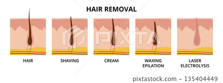 Hair removal methods. Hair, shaving, cream, waxing epilation, laser electrolysis 135404449