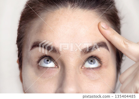Caucasian woman portrait after botox injections, dysport. Woman points her finger at her forehead without wrinkles. Remarkable result after the procedure. Close up photo 135404485