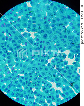 Onion cell mitosis under microscope at 40x magnification showing plant chromosomes and dividing nuclei for biology education, genetics research and cytology illustration 135410101