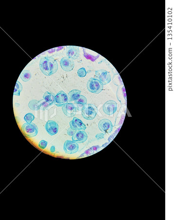 Lily anther cells showing meiosis under microscope at 40x magnification used for plant reproduction study, genetics education and cellular division research illustration 135410102