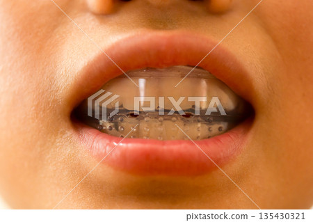 younger, baby boy, boy 135430321