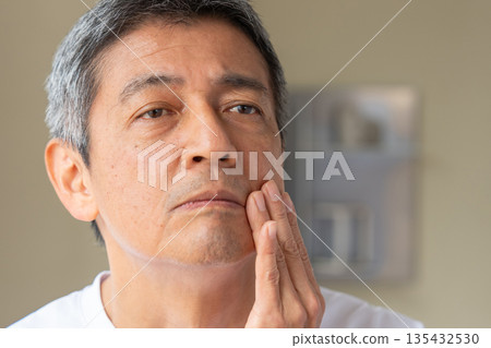 Middle-aged man suffering from skin problems 135432530
